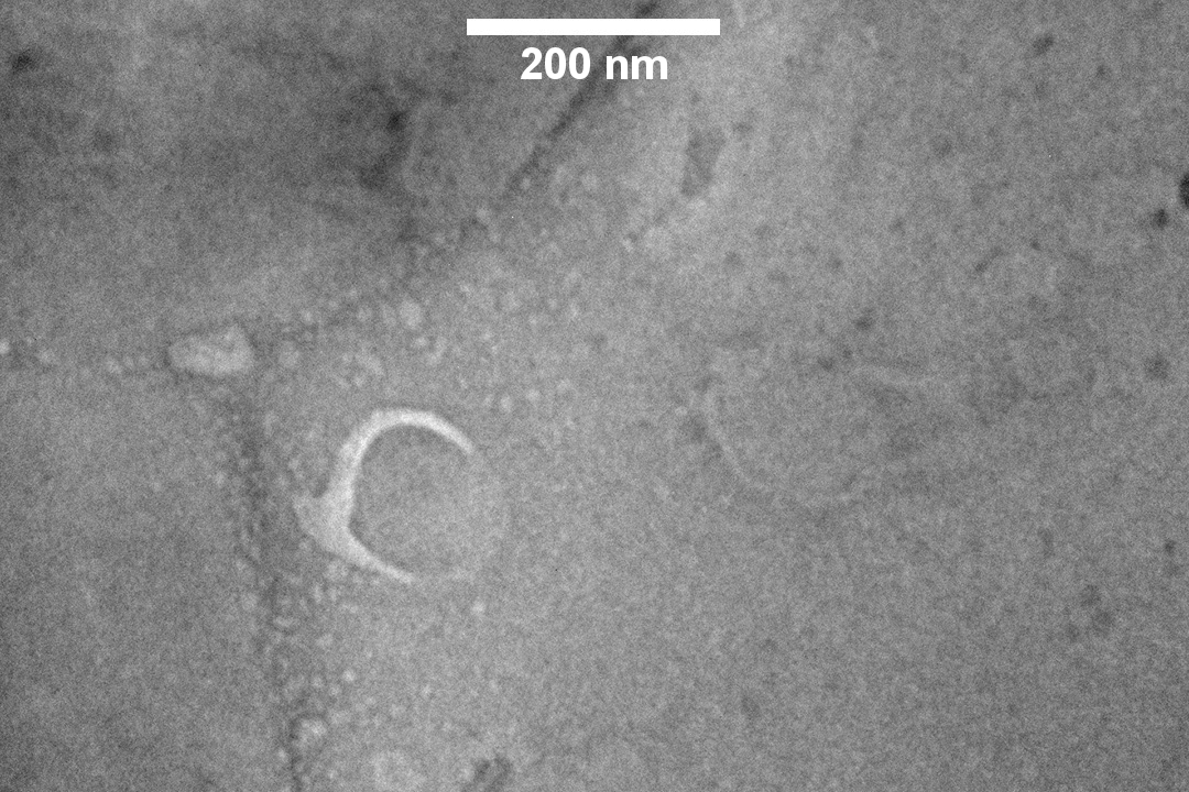Extracellular vesicle in a Graphene Liquid Cell, room temperature LP-TEM